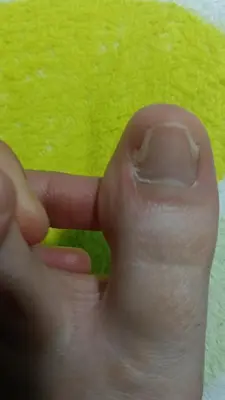 a hand with a thumb pointing at a green substance at Apartaestudio Ríonegro in Rionegro